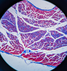 photo of striated muscle tissue under the microscope