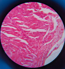 photo of esophagus tissue underr the microscope