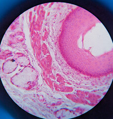 photo of esophagus tissue underr the microscope