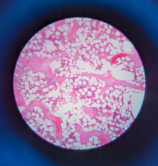 photo of fibro cartlige tissue underr the microscope