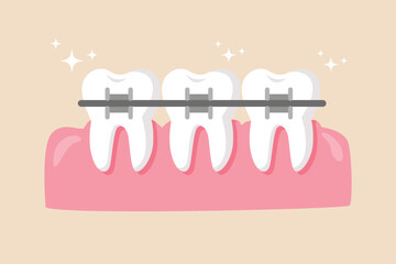 Dentist who put braces on the people gum. Dentist concept. Colored flat vector illustration.