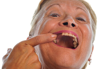 Adult woman points out that her teeth hurt. Lack of public dentists