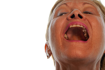 Elderly female patient opens her mouth and shows her teeth. Dental problems