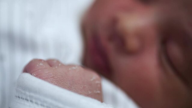 Close Up View Of Dry Broken Skin On New Born Baby's Hand. Foreground Focus, Slow Motion