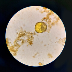 Urbanorium parasite analyzed under a microscope