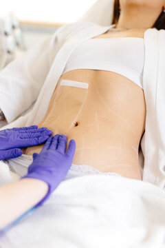 Procedure of lifting body with transparent pads in cosmetology salon