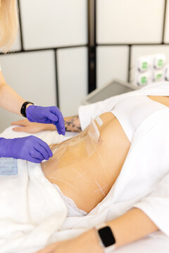 Doctor preparing area of abdomen before applying medical equipment