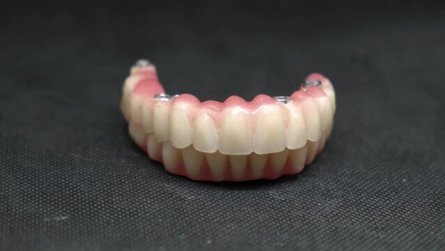 temporary full removable dentures after manufacture