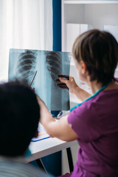 Female Doctor Analyzing X -Ray Image