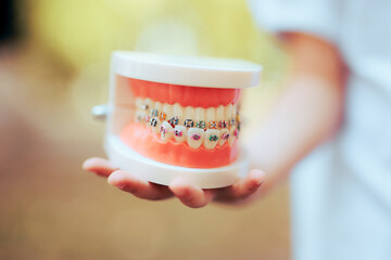 Little Child Holding a Dental Orthodontic Teeth Model with Braces. Hand presenting a medical prop...