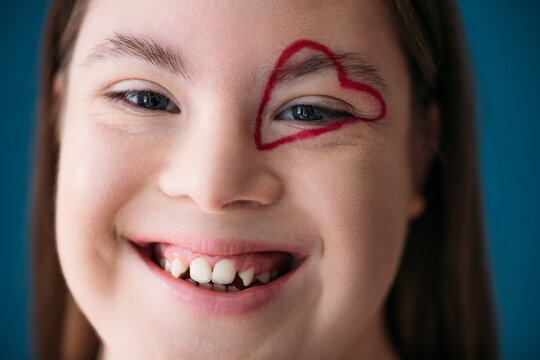 Girl with Heart on Her Eye