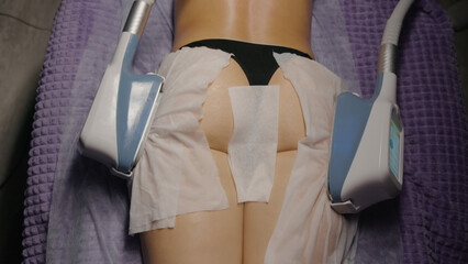 Woman getting cryolipolysis anti-fat anti-cellulite freezing treatment procedure in spa salon. Hardware cosmetology. Wellness body and skin care, beauty treatment, receiving rejuvenation procedure