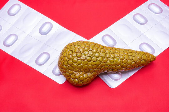 Pancreas, pills and treatment concept photo. The anatomical model of the pancreas is on two blisters with tablets top view. Idea for gastroenterology