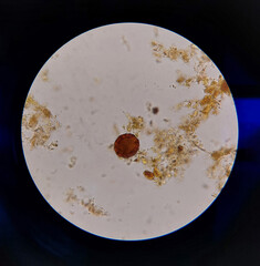Ascaris lumbricoides egg laboratory microscope