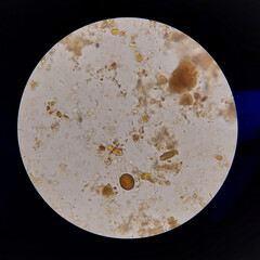 Taenia sp egg microscope  parasitology laboratory