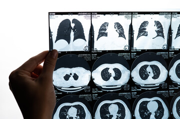 A female doctor examines an MRI scan of the internal organs. Abdomen.