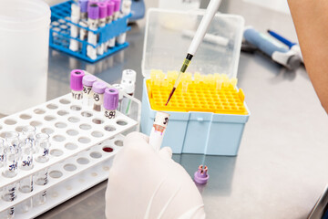 Scientist preparing bone marrow samples for flow cytometric analysis in the laboratory.