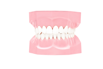 Dentures made out of plaster cast