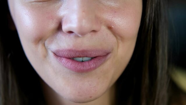 Beautiful smiling girl with brackets for teeth. Smiling woman. Female smile with dental braces close up. Braces Mouth