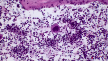 Megakaryocyte. The largest cell in the red bone marrow is the megakaryocyte (located in the center). Megakaryocyte is a bone marrow cell responsible for the production of blood platelets. 