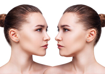 Young woman before and after chin correction. Over white background. - obrazy, fototapety, plakaty