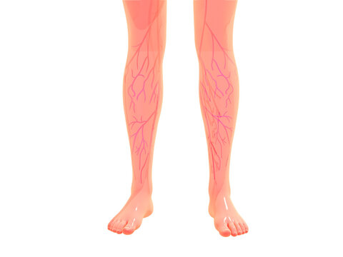 3d illustration of varicose veins in legs seen from the front. Circulatory system, veins.