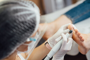 Podologist female doctor in mask on face, making procedure for foot with special equipment, close up