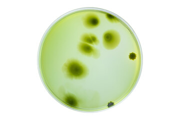 Petri dish and culture media with bacteria on white background with clipping, Test various germs, virus, Coronavirus, Corona, COVID-19, Microbial population count. Food science.