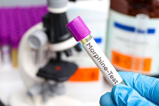 Morfina Bilder Durchsuchen 6,728 Archivfotos, und