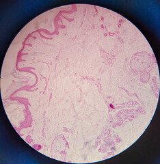 photo of tissue under the microscope