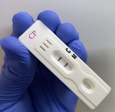 Rapid test device for Chlamydia pneumoniae (CP) IgM test.