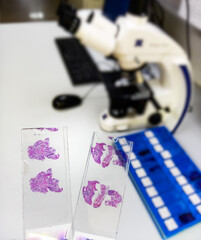 Close view of Histopathology slides stained with hematoxylin and eosin or HE stain, ready for...