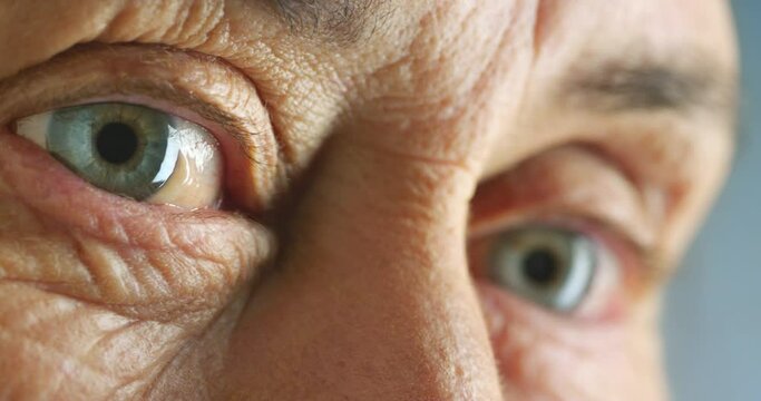 Eyes of elderly senior woman with poor mental health, blinking into light and forgetful or confused. A close up of tired wrinkles on skin around unhappy eye showing stress, fatigue and even dementia