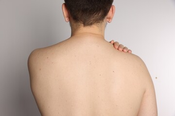Naklejka premium Closeup of man's body with birthmarks on light grey background, back view