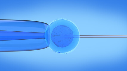 In vitro fertilization (IVF) is a process of fertilization where an egg is combined with sperm in vitro. Test tube baby in lab for pregnancy	 - obrazy, fototapety, plakaty