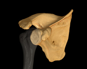 CT Shoulder 3D