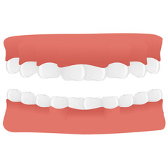Jaw in realistic style. Teeth set. Colorful png illustration isolated on background.