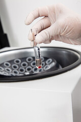 Test tube with bone marrow cells pellet obtained after centrifugation. Scientist preparing bone marrow samples for flow cytometric analysis in the laboratory.