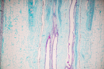 Plant tissue Structure, section (tissue) of stem plant tissue under a light microscope.