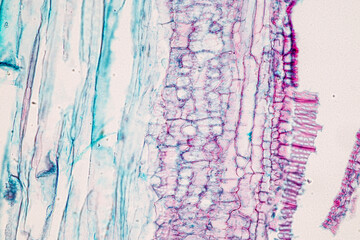 Plant tissue Structure, section (tissue) of stem plant tissue under a light microscope.