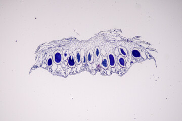 Plant tissue Structure, section (tissue) of stem plant tissue under a light microscope.