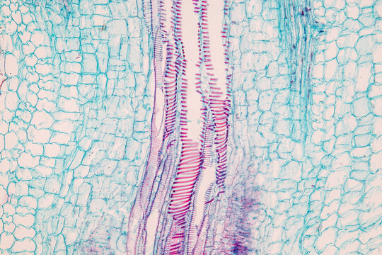 Plant tissue Structure, section (tissue) of stem plant tissue under a light microscope.