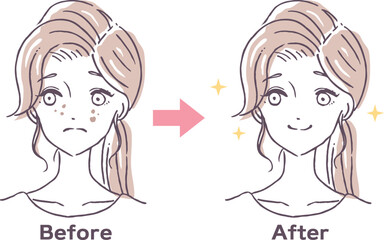顔のシミに悩む女性のビフォーアフターイラスト素材　しみ　改善　美容
