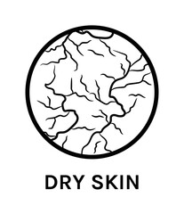 Dry Skin. Icon. Skin Problem. Close up of Dehydrated Unhealthy Skin. Flat Black White color. White background. Vector illustration for Beauty Cosmetic Design.