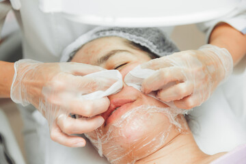 Fototapeta premium A cosmetologist in a beauty salon does a mechanical cleaning of a woman's face with his own hands. acne removal. heavily polluted face.