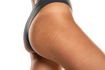 Female tanned hips with a stretch marks and cellulite on white background.