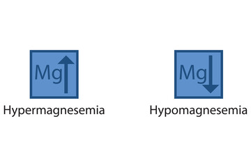 Hypermagnesemia and Hypomagnesemia – Magnesium Mg excess and deficit electrolyte disorder, blue arrow icon vector illustration