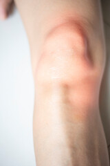 Close-up view of the leg muscles in the knee area.