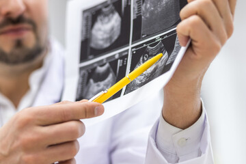 Cropped photo of doctor wearing lab coat showing an ultrasound result to his patient.