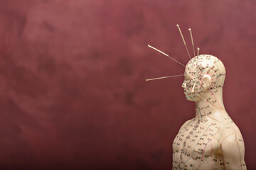 acupuncture model with needles in the head.